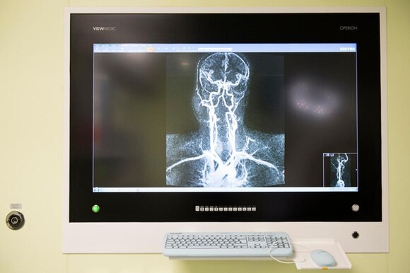 radiografia su uno schermo di computer