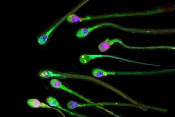 Spermatozoi umani al microscopio.